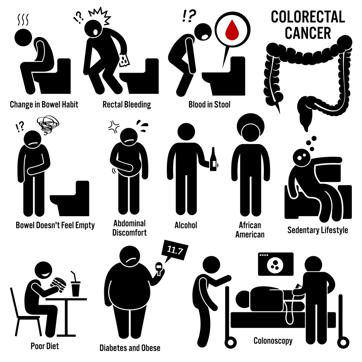 Depending on where the cancer starts, bowel cancer is sometimes called colon or rectal cancer. (Shutterstock) Depending on where the cancer starts, bowel cancer is sometimes called colon or rectal cancer. (Shutterstock)