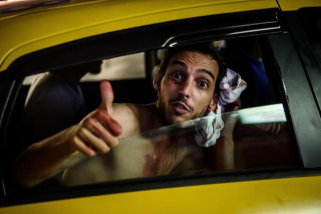 An injured man reacts as he goes to a hospital at Taksim square in Istanbul on July 16, 2016. (Ozan Kose / AFP)