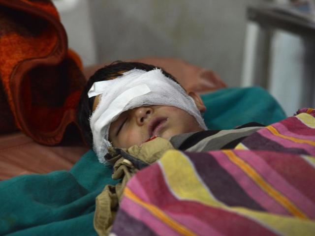Five-year old Nasir Ahmed Khan recuperating in a hospital in Srinagar after sustaining an eye injury allegedly in security forces action in Anantnag district. (AFP) Five-year old Nasir Ahmed Khan recuperating in a hospital in Srinagar after sustaining an eye injury allegedly in security forces action in Anantnag district. (AFP)