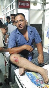 Another injured Pawan Thakur. (Karun Sharma/HT Photo) Another injured Pawan Thakur. (Karun Sharma/HT Photo)