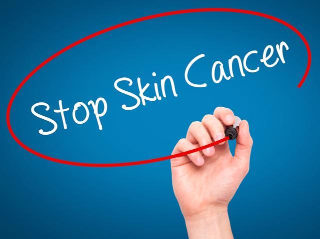 Teaching your partner how to identify new cancerous moles can be effective way to detect the disease. (Shutterstock) Teaching your partner how to identify new cancerous moles can be effective way to detect the disease. (Shutterstock)