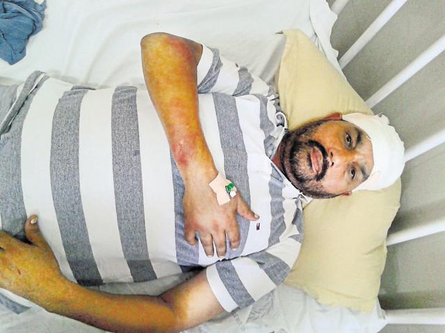 ASI Manohar Lal admitted to civil hospital in Nawanshahr(HT Photo)