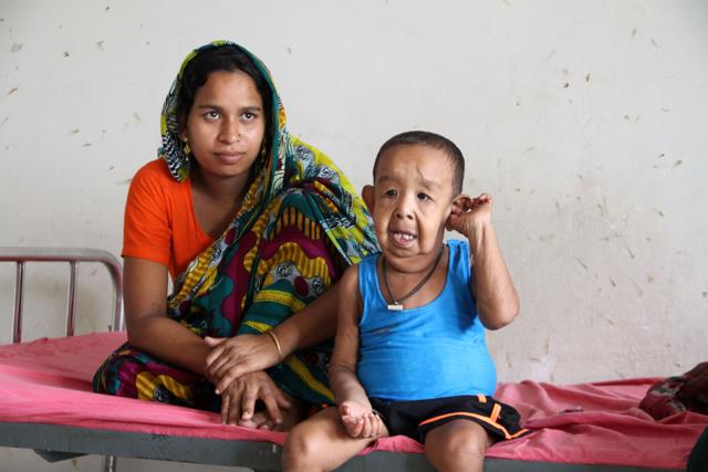 In this photograph taken on August 7, 2016, four-year-old Bangladeshi child Bayezid Shikdar(R) sits with his mother Tripti Khatun on a bed at Dhaka Medical College Hospital in Dhaka. (AFP Photo) In this photograph taken on August 7, 2016, four-year-old Bangladeshi child Bayezid Shikdar(R) sits with his mother Tripti Khatun on a bed at Dhaka Medical College Hospital in Dhaka. (AFP Photo)