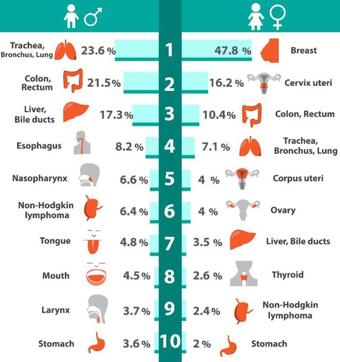 Top 10 kinds of cancer found in men and women. (Shutterstock)