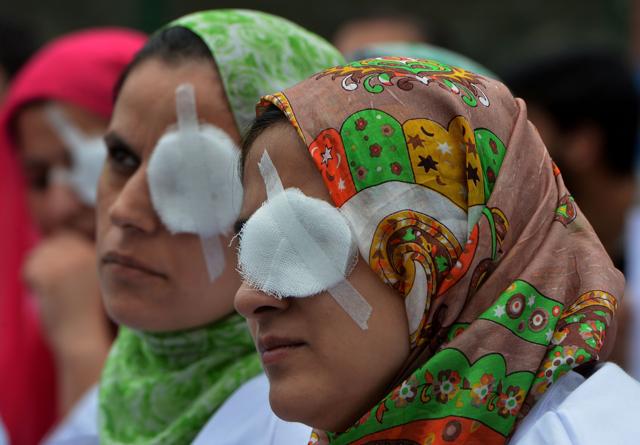 Kashmiri doctors and paramedics, their eyes covered by patches, take part in a protest at a hospital in Srinagar on August 10, 2016. The protesters covered one of their eyes to emulate the plight of the victims of pellet guns, who have been left partially or completely blind after being shot during ongoing protests. (AFP) Kashmiri doctors and paramedics, their eyes covered by patches, take part in a protest at a hospital in Srinagar on August 10, 2016. The protesters covered one of their eyes to emulate the plight of the victims of pellet guns, who have been left partially or completely blind after being shot during ongoing protests. (AFP)