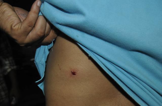An airgun is similar to the much-maligned pellet gun, in news for its use in Kashmir these days. (HT Photo)