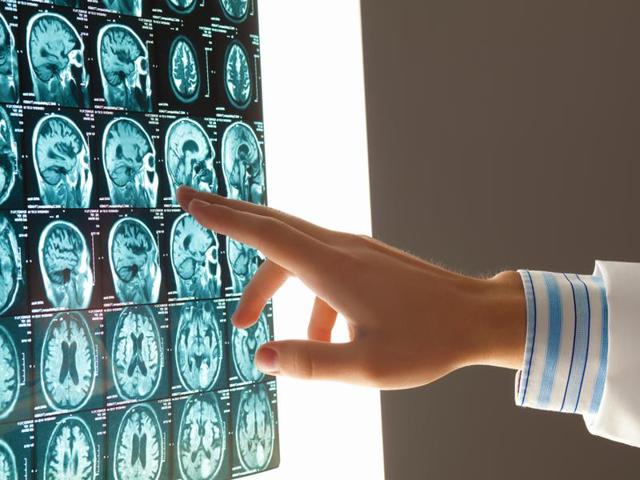 Brain injury suffered early in life invariably led to risk of premature mortality among other such problems.(Shutterstock)