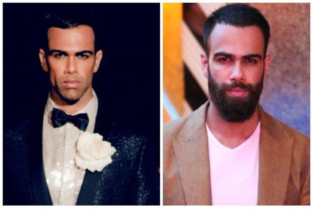 The before-and-after look of Saud Khan (Photo: Facebook) The before-and-after look of Saud Khan (Photo: Facebook)