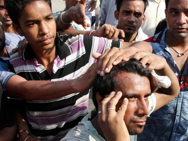A protester shows bruises as he was hit by the cops during canecharge in Ludhiana on Monday. (JS Grewal/HT Photo)