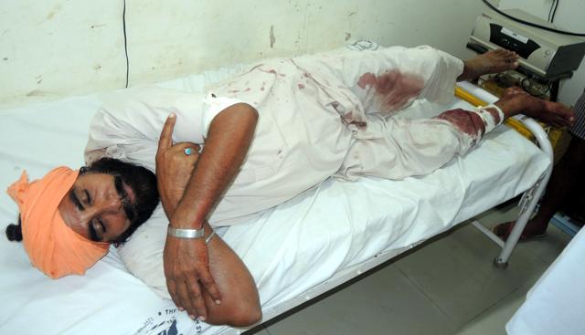 A man injured in the clash. (HT Photo)