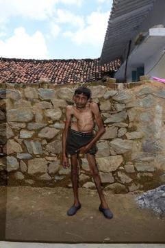 One of the local villagers who came to the camp for treatment. (Photo courtesy: Jal Jangal Jamin) One of the local villagers who came to the camp for treatment. (Photo courtesy: Jal Jangal Jamin)