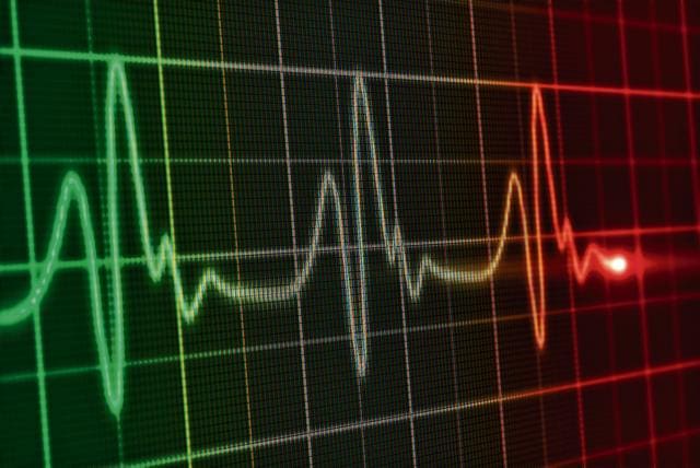 Electrocardiogram line on heart monitor.(Getty Images/iStockphoto) Electrocardiogram line on heart monitor.(Getty Images/iStockphoto)