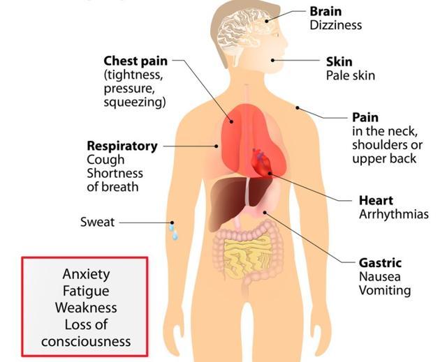The warning signs of heart attack. (Shutterstock)