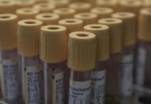 Blood samples that will be tested for dengue at Surana Hospital in Mumbai. (Satish Bate/HT PHOTO)