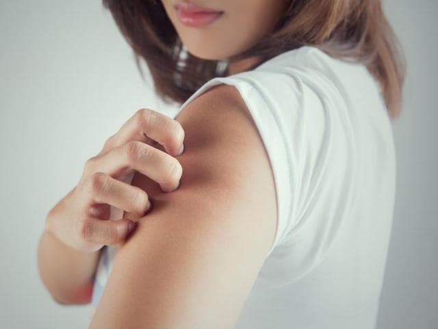 Atopic eczema causes distressing itchy lesions that can lead to broken skin with increased susceptibility to infection. (Shutterstock) Atopic eczema causes distressing itchy lesions that can lead to broken skin with increased susceptibility to infection. (Shutterstock)