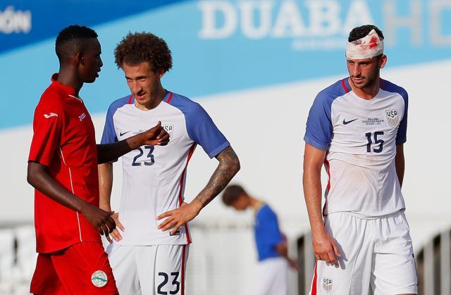 Steven Birnbaum (#15) walks off the pitch after getting patched up. (AFP)
