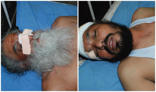 The injured cashvan driver Kashmir Singh and guard Makhan Singh in hospital. (HT Photos)