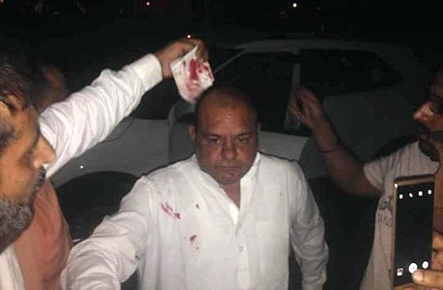 District Congress chief Gurpreet Gogi injured in the clash.. (HT Photo)