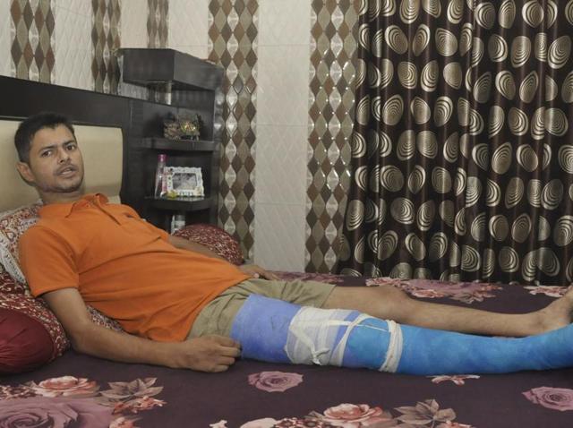 Injured Ashish Sohal at his residence in Jalandhar on Wednesday.(Sikander Singh Chopra/HT Photo)