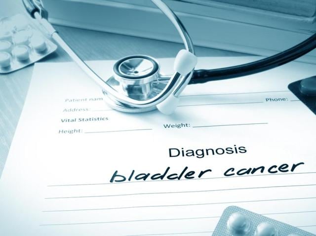 Bladder cancer is the seventh most common cancer in males worldwide, say researchers. (Shutterstock) Bladder cancer is the seventh most common cancer in males worldwide, say researchers. (Shutterstock)