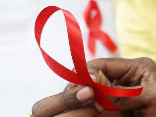 The risk of contracting active tuberculosis is around 30 times higher for people who are HIV-positive, say researchers.(Shutterstock)