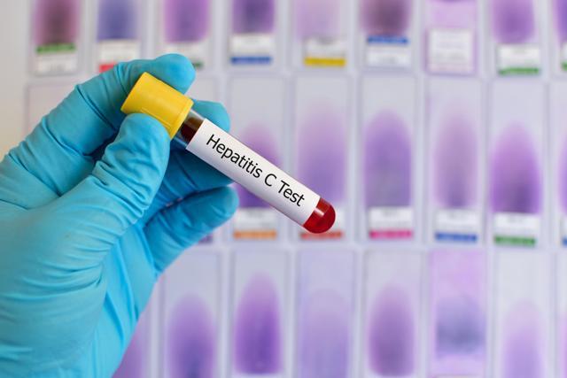 For viral diseases such as HIV or hepatitis C protective vaccines remain unavailable. (Shutterstock)
