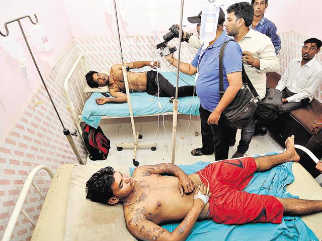 Devesh and Deepu were trying to resolve a dispute when they were allegedly attacked by factory workers, who threw a jug of acid at them. (HT File) Devesh and Deepu were trying to resolve a dispute when they were allegedly attacked by factory workers, who threw a jug of acid at them. (HT File)
