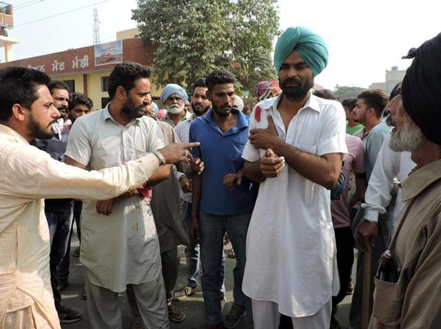 A man shows an injury after a clash between two groups of transporters in Maur on Monday. (Sanjeev Kumar/HT Photo) A man shows an injury after a clash between two groups of transporters in Maur on Monday. (Sanjeev Kumar/HT Photo)