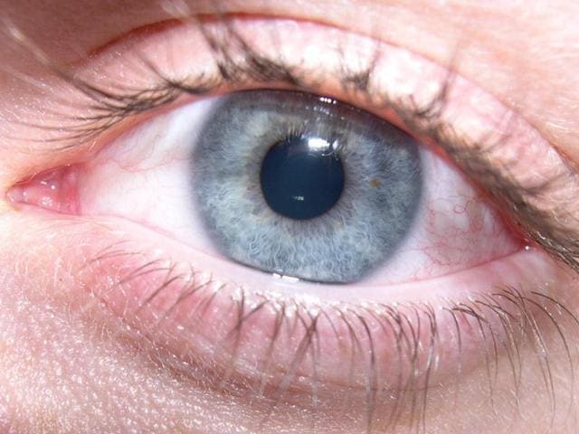 Eye disease is caused by changes in the gut bacteria. Eye disease is caused by changes in the gut bacteria.