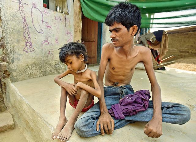 Suresh Adivasi, 25, recently lost a 3-year-old daughter to TB. He has it too, as does his son Manish, 6. They have stopped taking their medication because they say it makes them feel sicker. Side-effects often cause villagers to stop taking their drugs, putting them at greater risk for drug-resistant TB.(Virendra Singh Gosain/HT PHOTO)