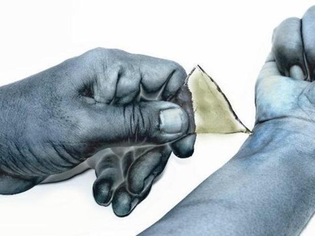 A PhD student at the University of Hyderabad (UoH) slit his wrist. (Representational Image) A PhD student at the University of Hyderabad (UoH) slit his wrist. (Representational Image)