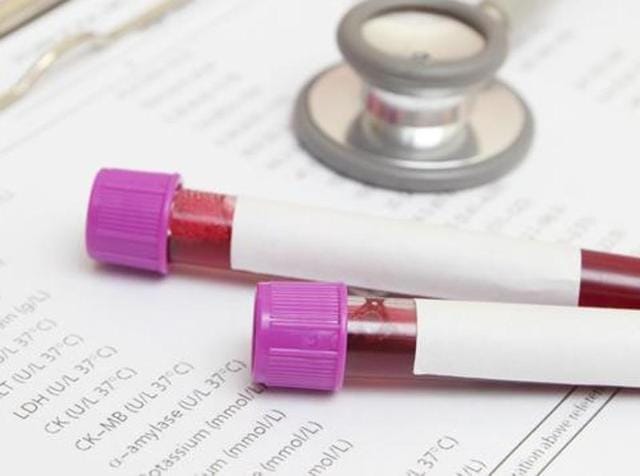 Blood banks said there is usually a sharp fall in donations around Diwali, as people go on vacations, but the shortage this year has lasted longer than usual. (HT Photo) Blood banks said there is usually a sharp fall in donations around Diwali, as people go on vacations, but the shortage this year has lasted longer than usual. (HT Photo)
