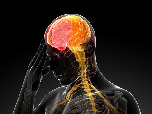 Ischemic stroke is caused by blood clots which block diseased or damaged cerebral arteries. (Shutterstock)