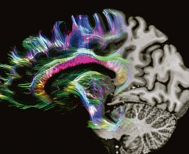 In the most complex part of the human body, anatomical brain images offer highly accurate renderings of fibre bundles. (Max Planck Institut, Leipzig, Germany) In the most complex part of the human body, anatomical brain images offer highly accurate renderings of fibre bundles. (Max Planck Institut, Leipzig, Germany)