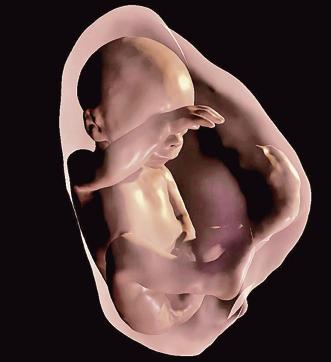 Virtual reality 3D models of foetuses help doctors diagnose and treat unborn babies.