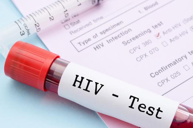 Between 2005 and 2015, the number of people with HIV who learned of their status increased from 12% to 60% globally. (Shutterstock) Between 2005 and 2015, the number of people with HIV who learned of their status increased from 12% to 60% globally. (Shutterstock)