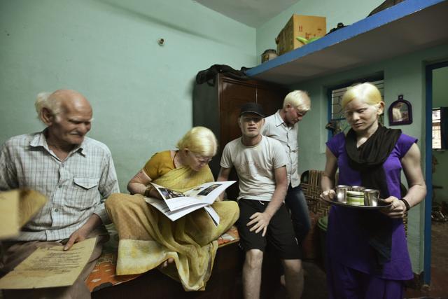 The 10 members of the Pullan family live in north Delhi’s Wazirpur and suffer from a congenital absence of pigment in the skin, hair and eyes. That makes their skin extremely fair and the target of people’s prejudices. (Arun Sharma/ HT Photo) The 10 members of the Pullan family live in north Delhi’s Wazirpur and suffer from a congenital absence of pigment in the skin, hair and eyes. That makes their skin extremely fair and the target of people’s prejudices. (Arun Sharma/ HT Photo)