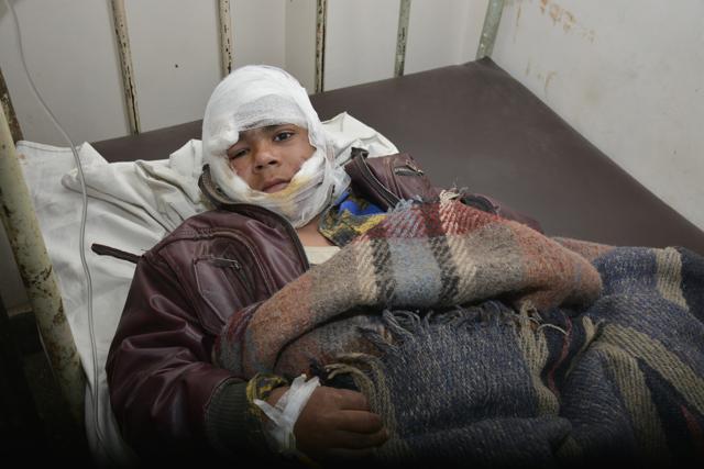 One of the injured children at the hospital. (Sakib Ali /HT Photo)