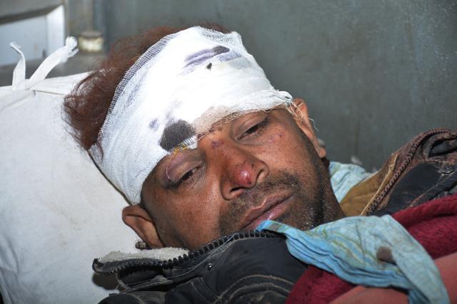 The house owner, Imran, was also injured. (Sakib Ali /HT Photo)