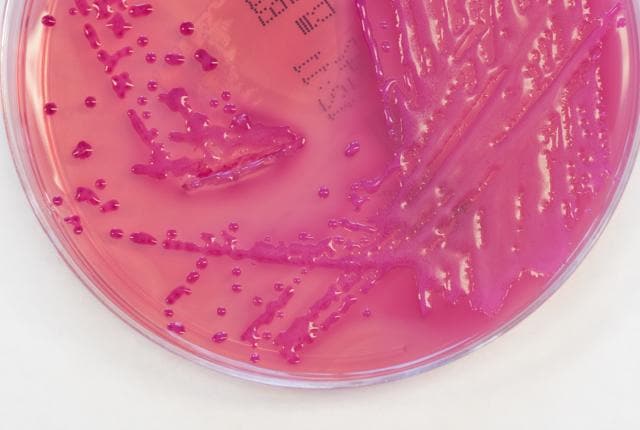 has been detected in bacteria in the UK, US, India, Pakistan, Croatia, Canada and Japan. (Istock)