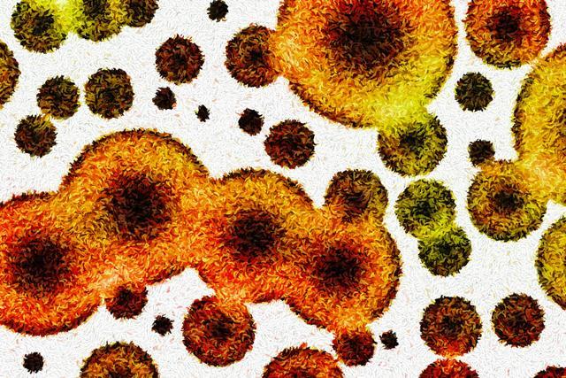 Superbug is a strain of bacteria that has become resistant to antibiotic drugs. (Shutterstock) Superbug is a strain of bacteria that has become resistant to antibiotic drugs. (Shutterstock)