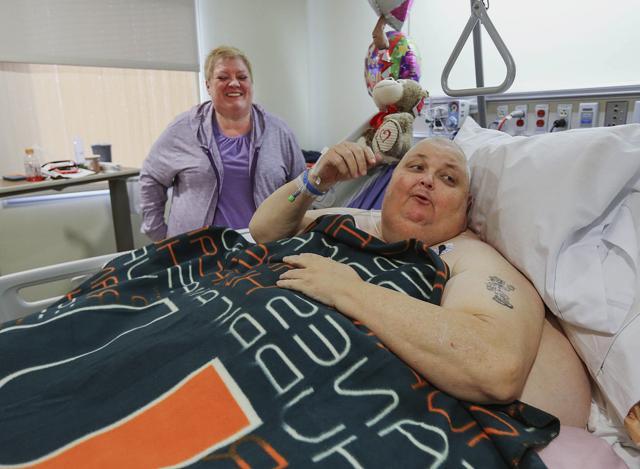 Kitty Logan stands by her husband Roger Logan as he rests on a bed at Bakersfield Memorial Hospital two days after he had his 130-pound tumour removed. (AP photo) Kitty Logan stands by her husband Roger Logan as he rests on a bed at Bakersfield Memorial Hospital two days after he had his 130-pound tumour removed. (AP photo)