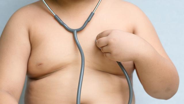 Obesity in children is a global problem. (Shutterstock) Obesity in children is a global problem. (Shutterstock)