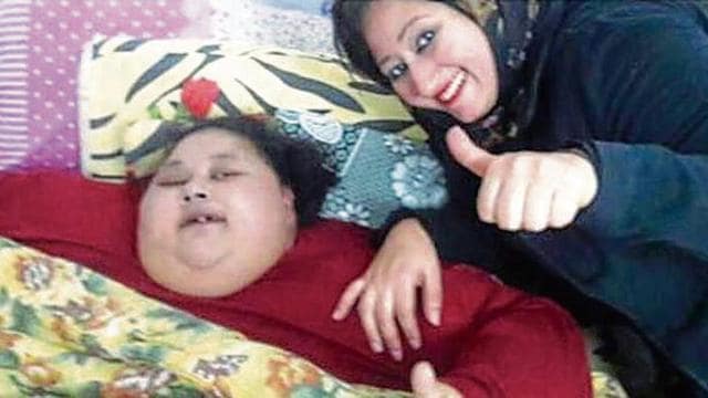 Eman Ahmed Abd El Aty (left) has not stepped out of her house in Cairo for the past 25 years. (HT Photo) Eman Ahmed Abd El Aty (left) has not stepped out of her house in Cairo for the past 25 years. (HT Photo)