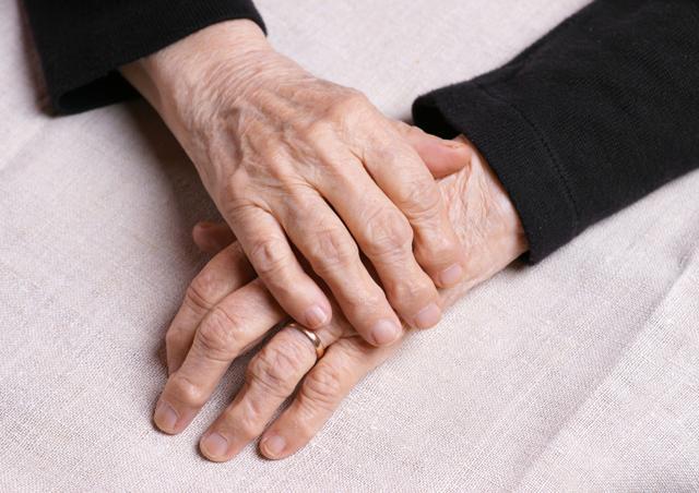 In Alzheimer’s disease, abnormal proteins form plaques and tangles in the brain which slowly damages it and causes severe cognitive decline. (Shutterstock)
