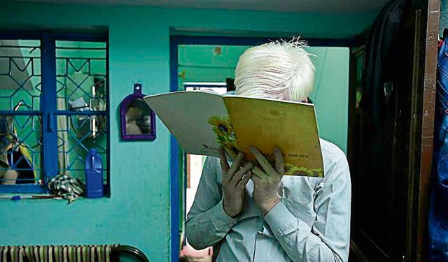 Vijay Kumar, one of the six siblings, in the Pullan family in Delhi says that they are often discriminated against and labelled ‘Angrez’ or ‘Surajmukhi’ because they suffer from Albinism. (Arun Sharma/HT PHOTO) Vijay Kumar, one of the six siblings, in the Pullan family in Delhi says that they are often discriminated against and labelled ‘Angrez’ or ‘Surajmukhi’ because they suffer from Albinism. (Arun Sharma/HT PHOTO)