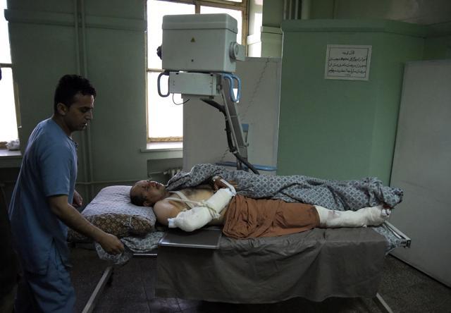 An injured Afghan patient is wheeled into position at an X-ray machine at a hospital in Kabul on March 9, 2017, after he was injured in an attack on the main military hospital in the Afghan capital. Terrorists wearing white medical coats stormed the Sardar Daud Khan Hospital on March 8, killing 49 people and wounding more than 70 other in a six-hour attack. (AFP) An injured Afghan patient is wheeled into position at an X-ray machine at a hospital in Kabul on March 9, 2017, after he was injured in an attack on the main military hospital in the Afghan capital. Terrorists wearing white medical coats stormed the Sardar Daud Khan Hospital on March 8, killing 49 people and wounding more than 70 other in a six-hour attack. (AFP)