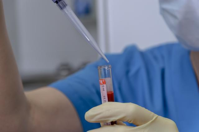 The phosphorylated proteins – known as phosphoproteins – have been seen as the prime candidates for cancer biomarkers. (Shutterstock)