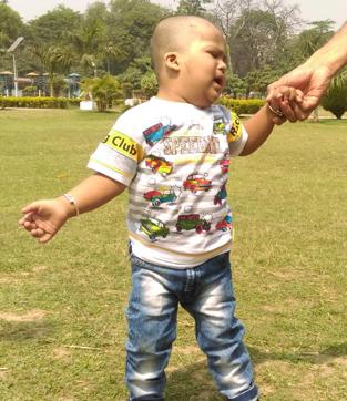 Atharv, 2, suffering from Down syndrome, underwent an open heart surgery when he was just over two months old to plug a hole in his heart. (HT photo) Atharv, 2, suffering from Down syndrome, underwent an open heart surgery when he was just over two months old to plug a hole in his heart. (HT photo)