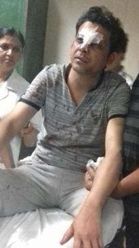Injured BJP worker Rahul Thakur (Chahatram/HT PHOTO)